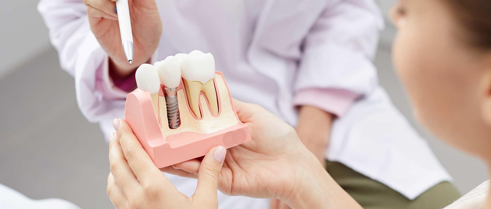 Zähne gesund erhalten